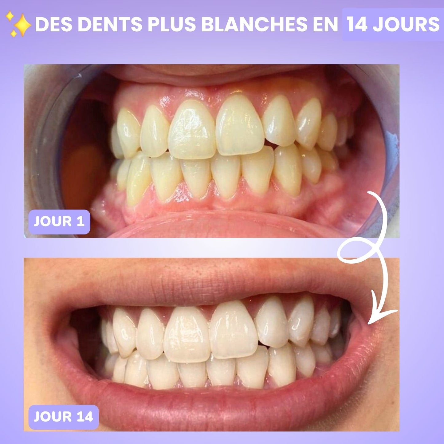 Bandes blanchissante