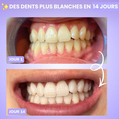 Bandes blanchissante