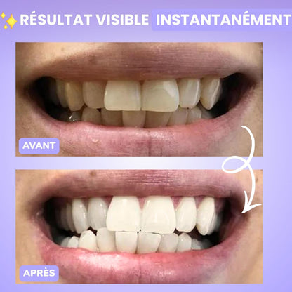 Poudre blanchissante V34