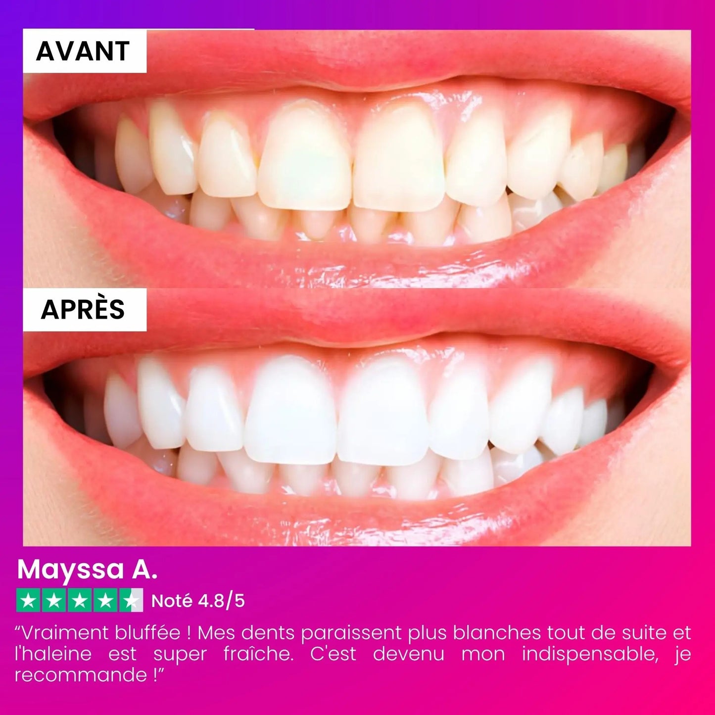 Poudre Blanchissante V34 IVI Smile