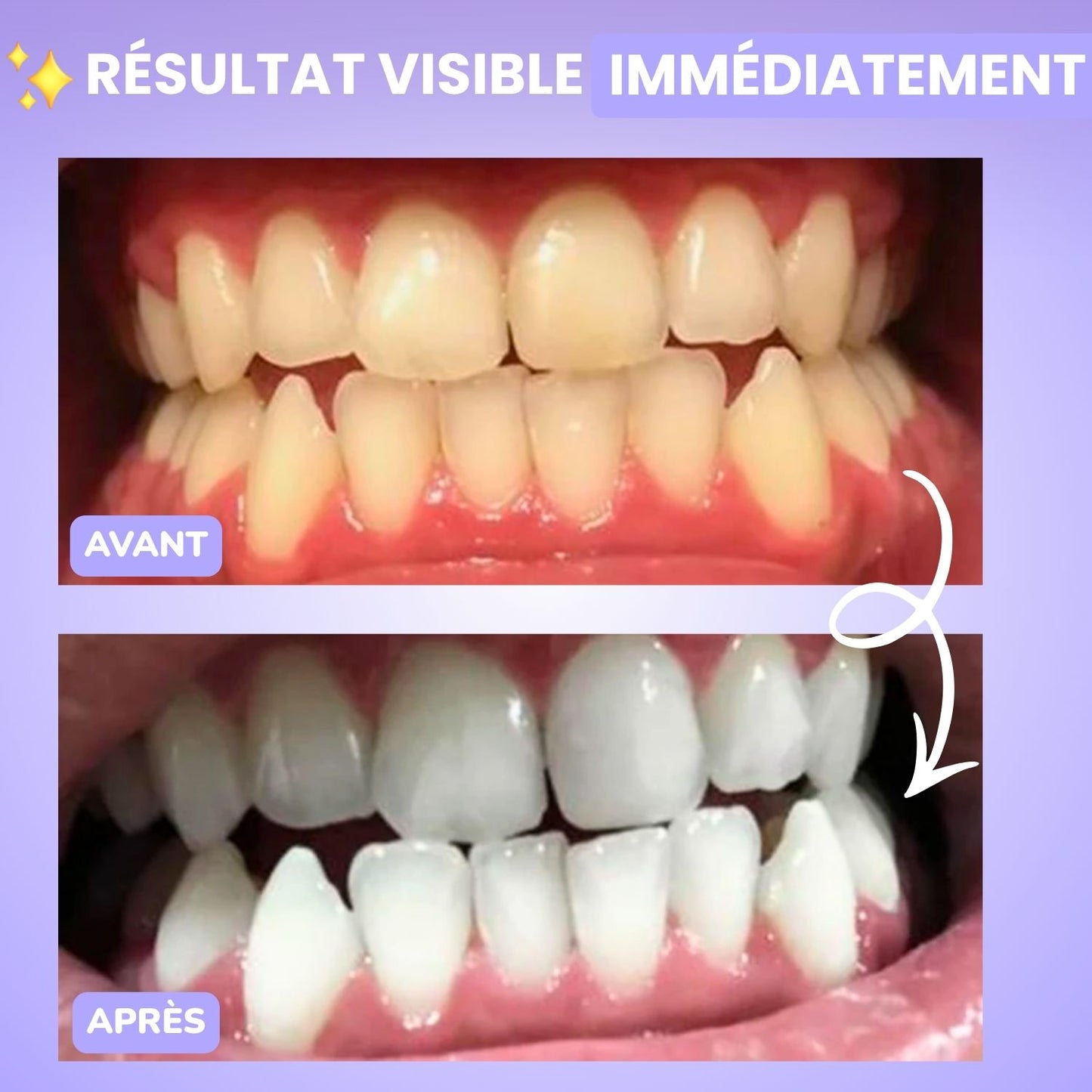 Sérum correcteur de couleur V34